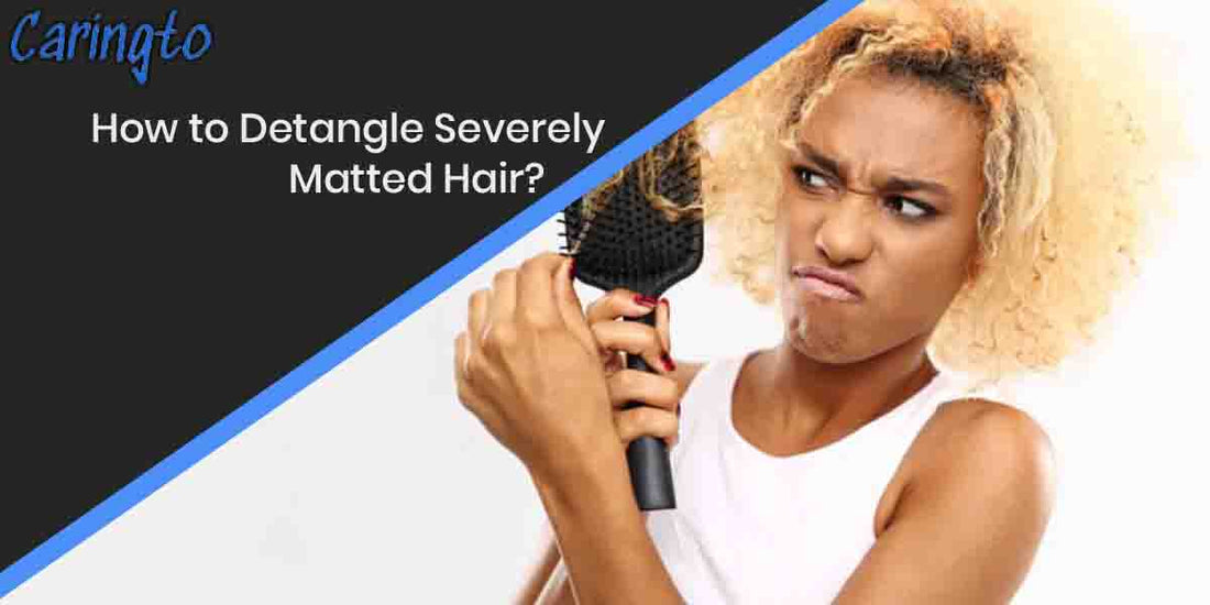 How to Detangle Severely Matted Hair