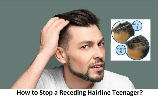 How to Stop a Receding Hairline Teenager
