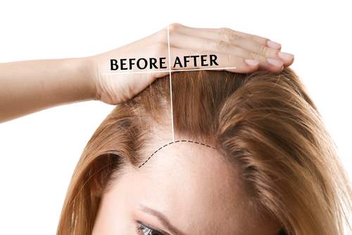 what-causes-frizzy-hair